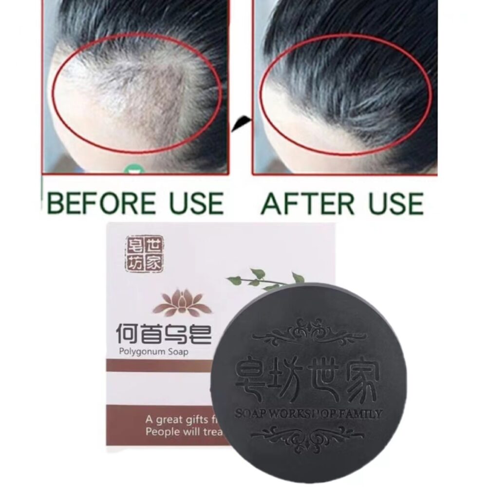 Polygonum Multiflorum Dry Hair Unisex Shampoo Soap Prevent Loss White Turn Black Antipruritic Moist Repair Quality Hair